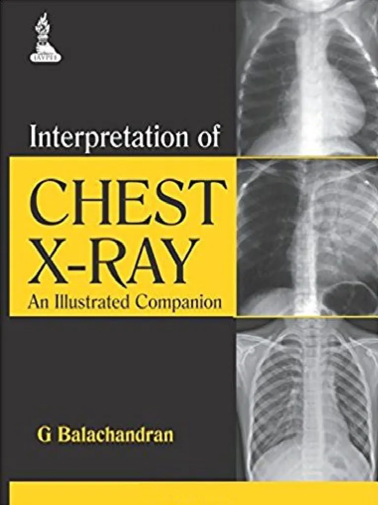 Interpreting Chest X-Rays Illustrated with 100 Cases 1st Edition