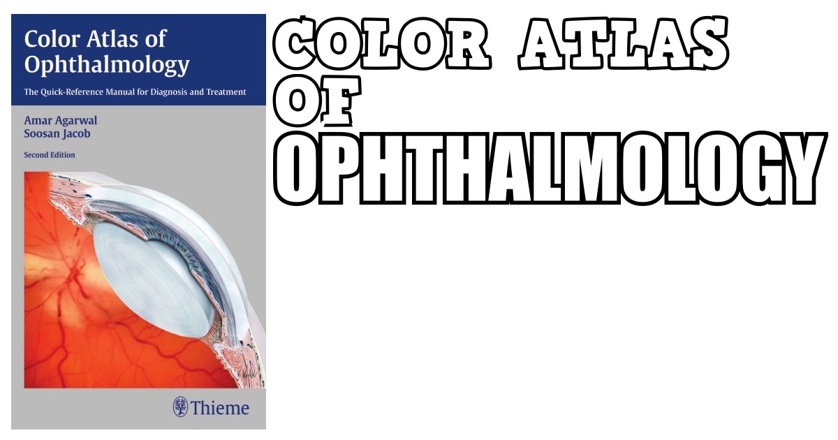 Download Color Atlas of Ophthalmology 3rd Edition PDF