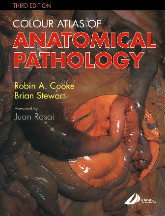 Colour Atlas of Anatomical Pathology 3rd Edition