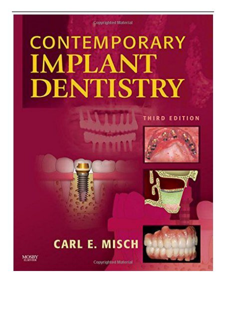 Contemporary Implant Dentistry 3rd Edition