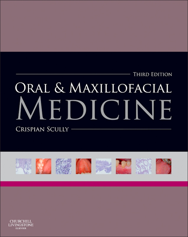 Download Oral and Maxillofacial Medicine Scully 3rd Edition