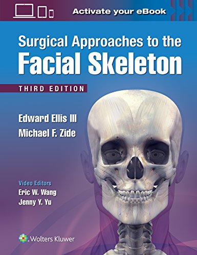 Surgical Approaches to the Facial Skeleton 3rd Edition 2019
