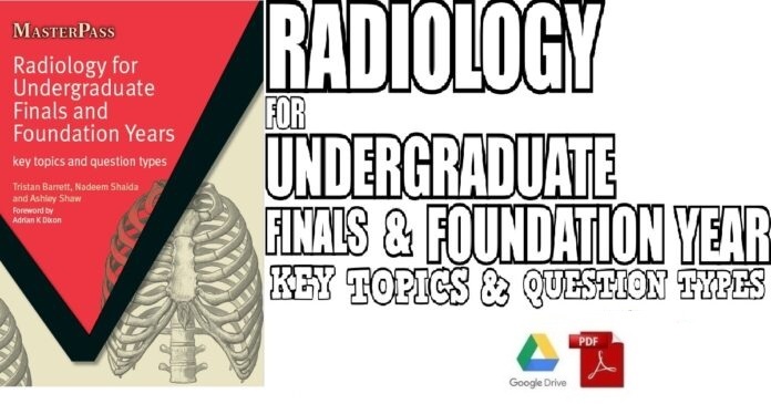 Radiology for Undergraduate Finals and Foundation Years Key Topics and Question Types