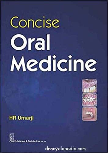 Concise Oral Medicine 1st Edition