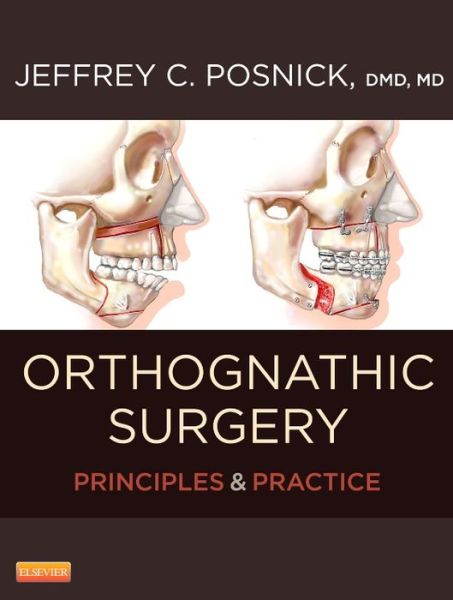 Principles and Practice of Orthognathic Surgery 1st Edition (2 Volume Set) 