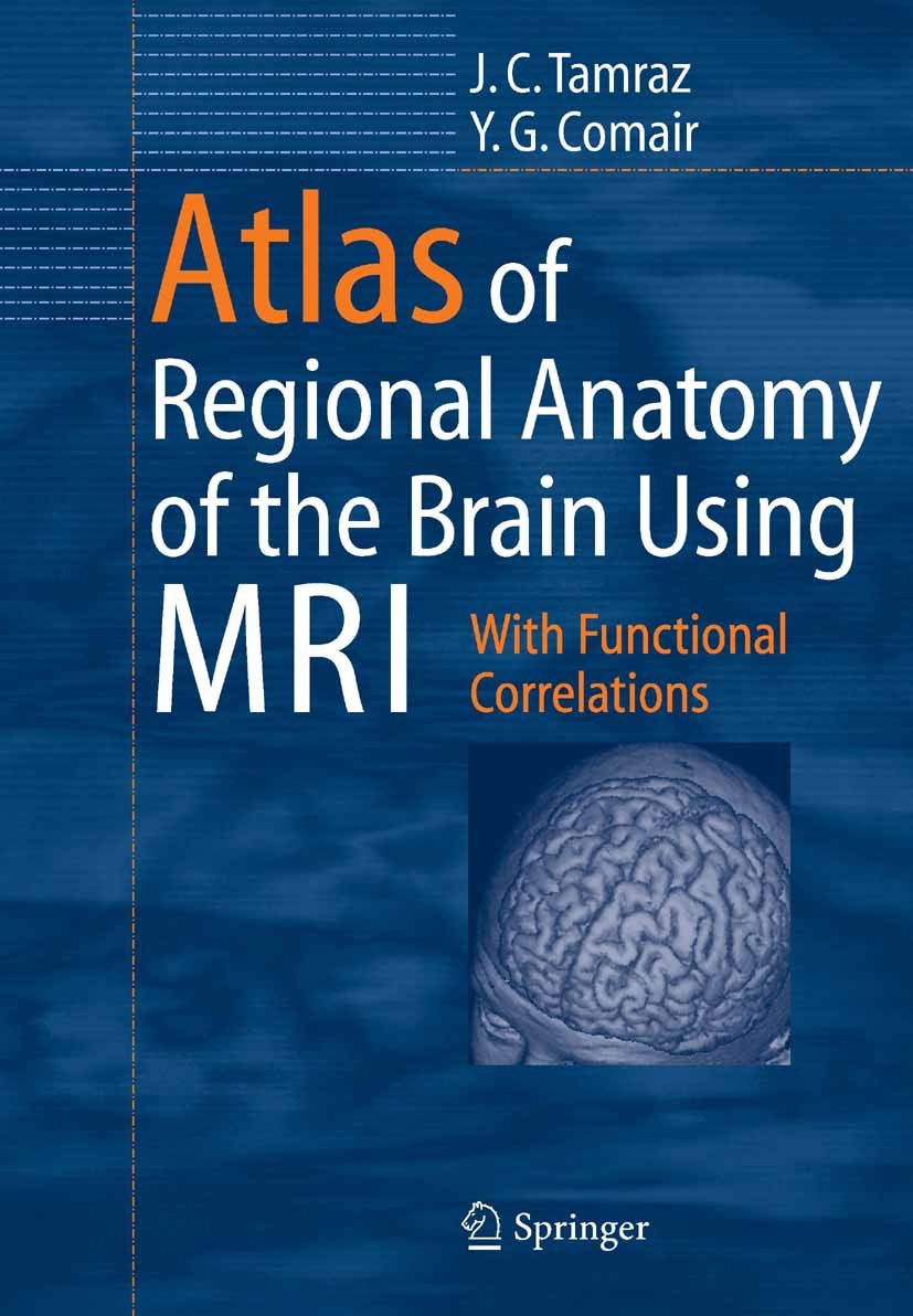 Atlas of Regional Anatomy of the Brain Using MRI With Functional Correlations 2nd Edition