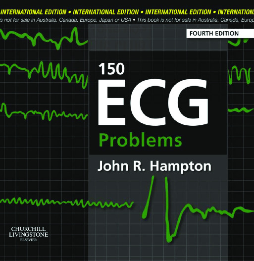 150 ECG Problems 2nd Edition
