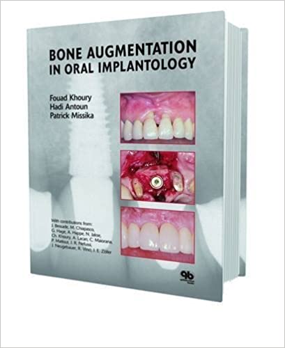 Bone Augmentation in Oral Implantology by Fouad Khoury