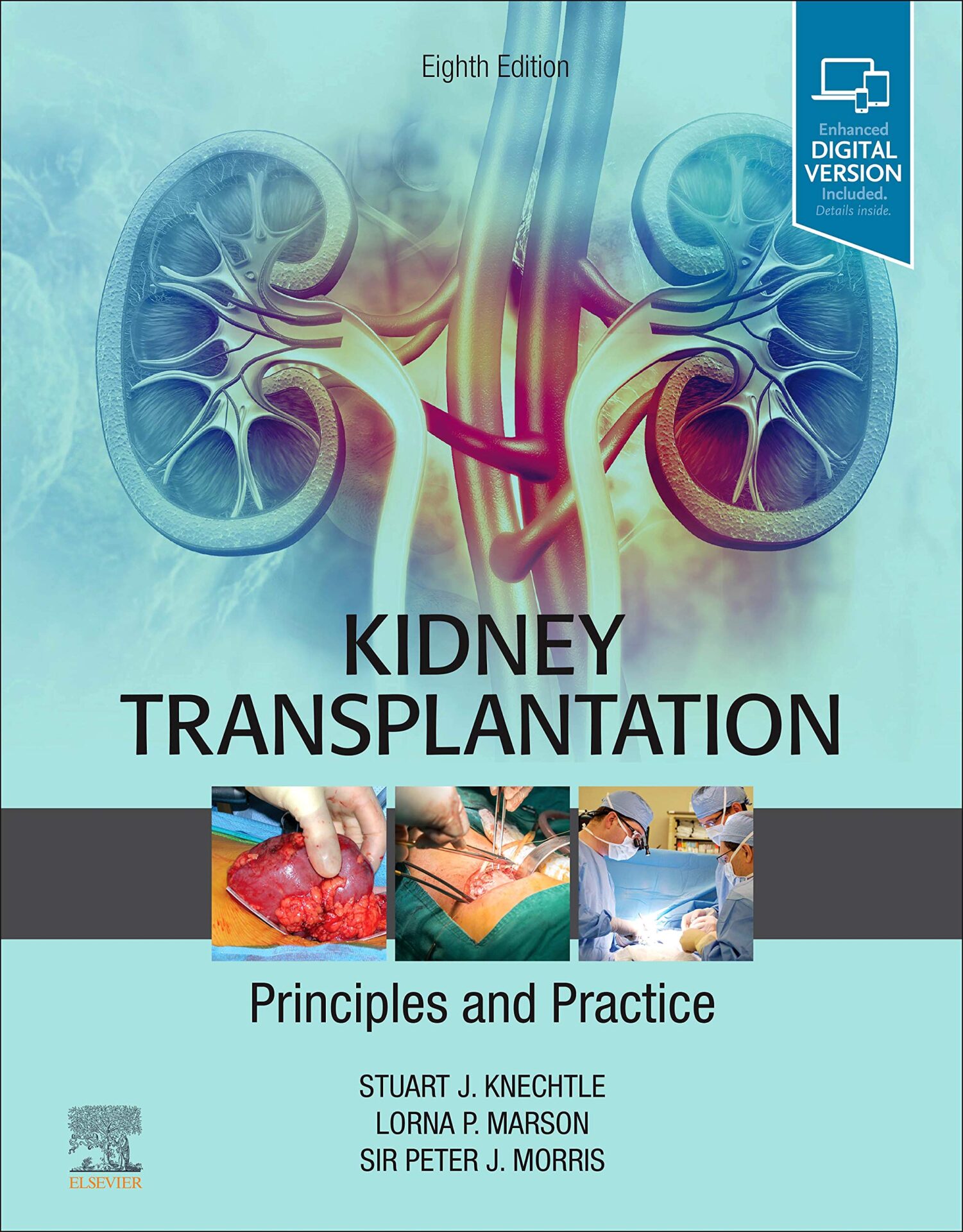 Kidney Transplantation: Principles and Practice, 6th Edition