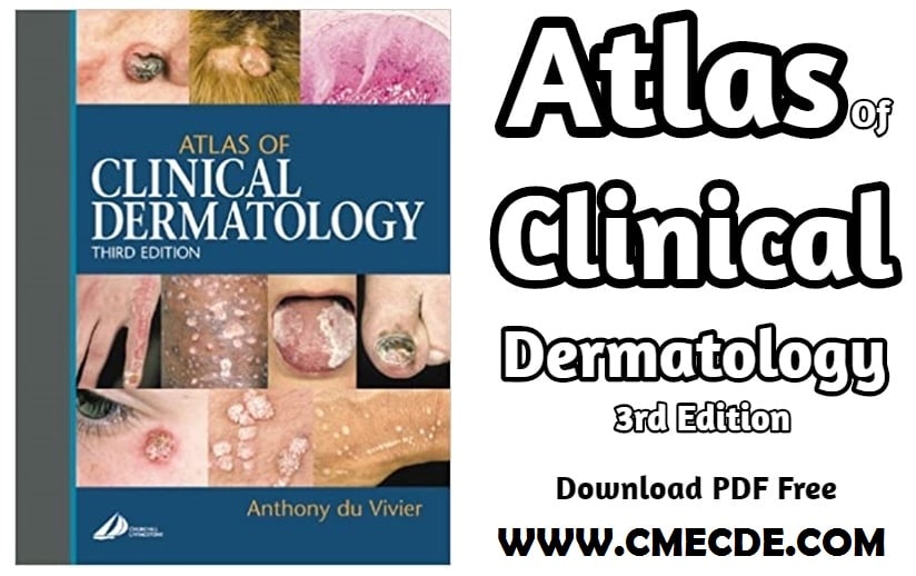 Atlas Of Clinical Dermatology 3rd Edition
