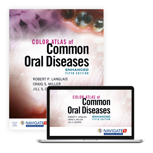 Color Atlas of Common Oral Diseases 5th Edition