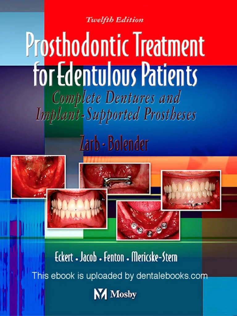 Prosthodontic Treatment for Edentulous Patients by Zarb 12th Edition