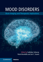 Mood Disorders (Brain Imaging and Therapeutic Implications) 1st Editio