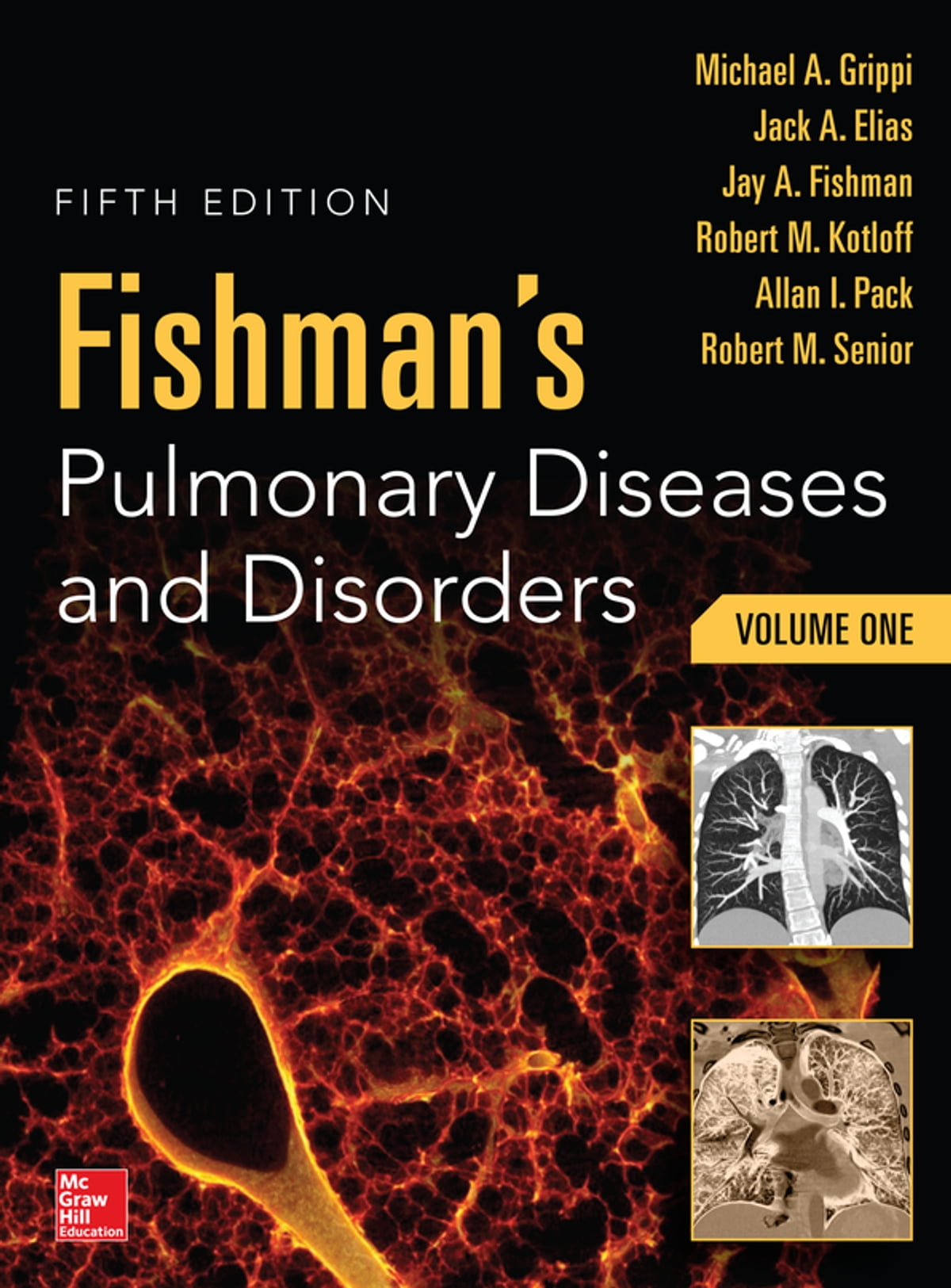 Fishman's Pulmonary Diseases and Disorders 2-Volume Set 5th edition