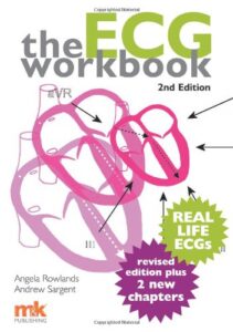 The ECG Workbook Second Edition