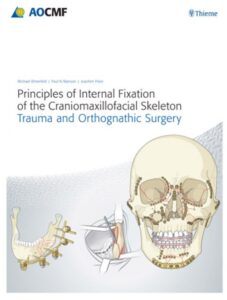 Principles of Internal Fixation of the Craniomaxillofacial Skeleton: Trauma and Orthognathic Surgery 1st Edition